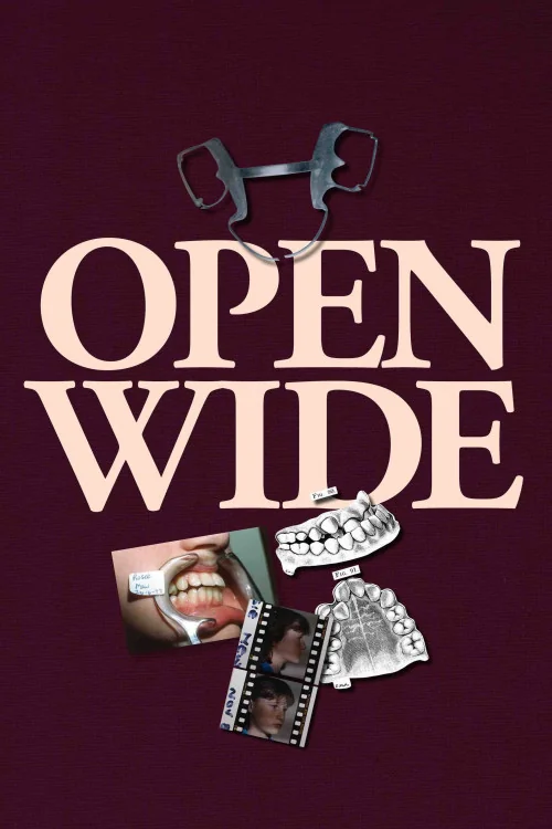 Open Wide